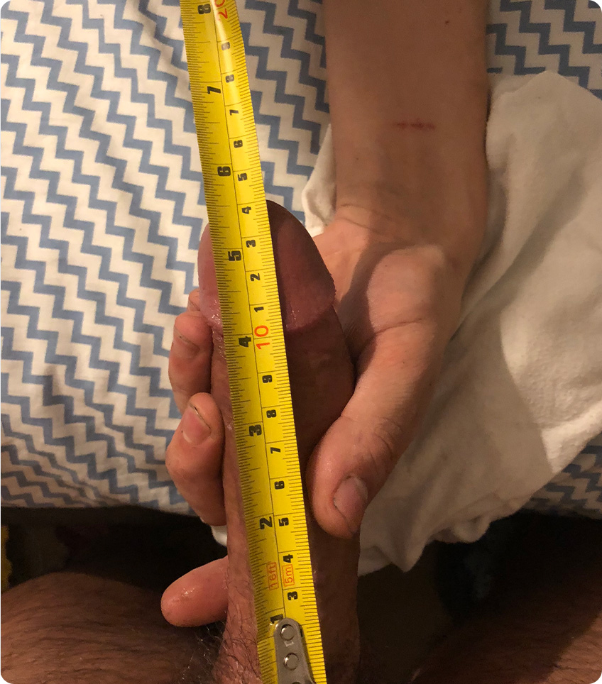 Penis Measurement